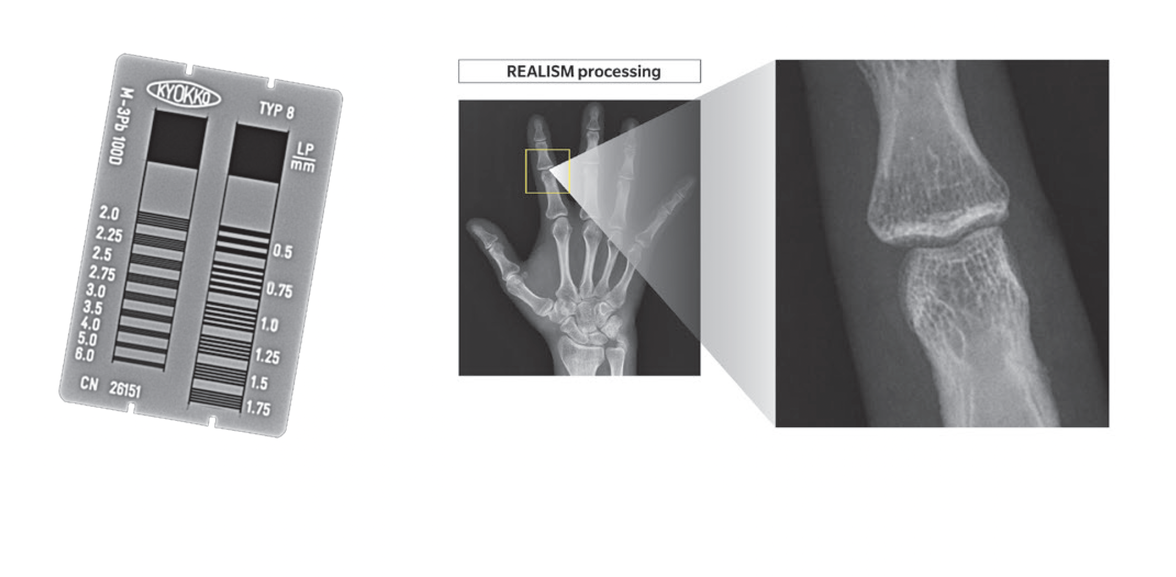 AeroDR GL - Realism processing