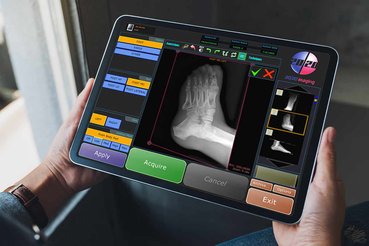 Opal interface